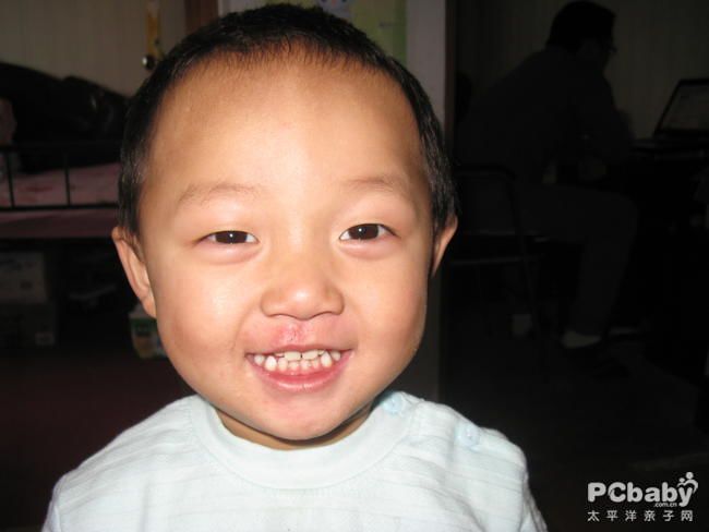 2--3岁宝宝牙齿发育和卫生