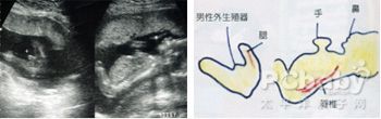 怀孕17周:胎儿的听觉发育十分成熟,不仅听到肚子里一些器官所发出