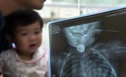 别看这些东西小 会要了孩子命