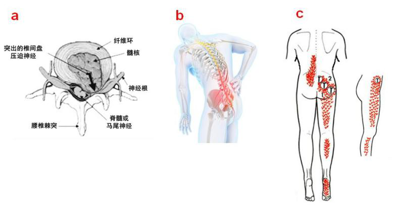 屁股退烧是什么原理_退烧红水是什么药(2)