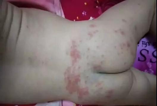 怒 销量百万纸尿裤全是垃圾货