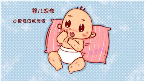 宝宝痒的难受,学会这4招轻松应对湿疹