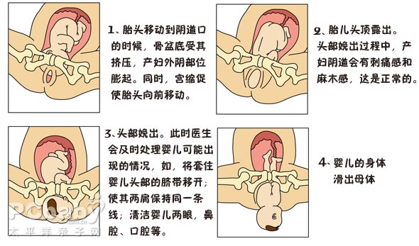 生过孩子的宫颈口图片