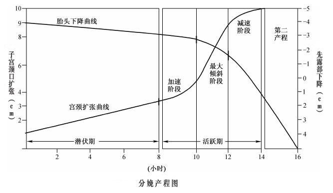 助产士如何画产程图图片